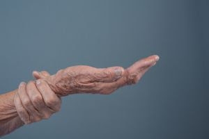 Nova terapia aprovada pela Anvisa reacende debate sobre tratamento do Parkinson avançado